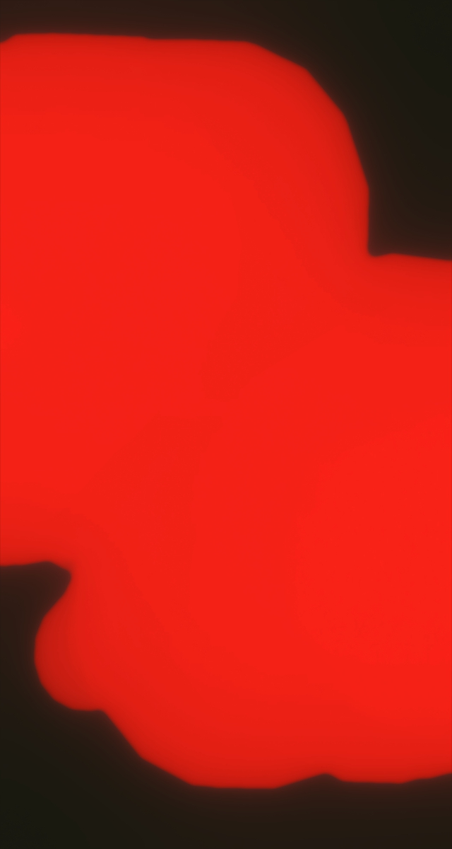 ultrasound_20260226_172457.jpg