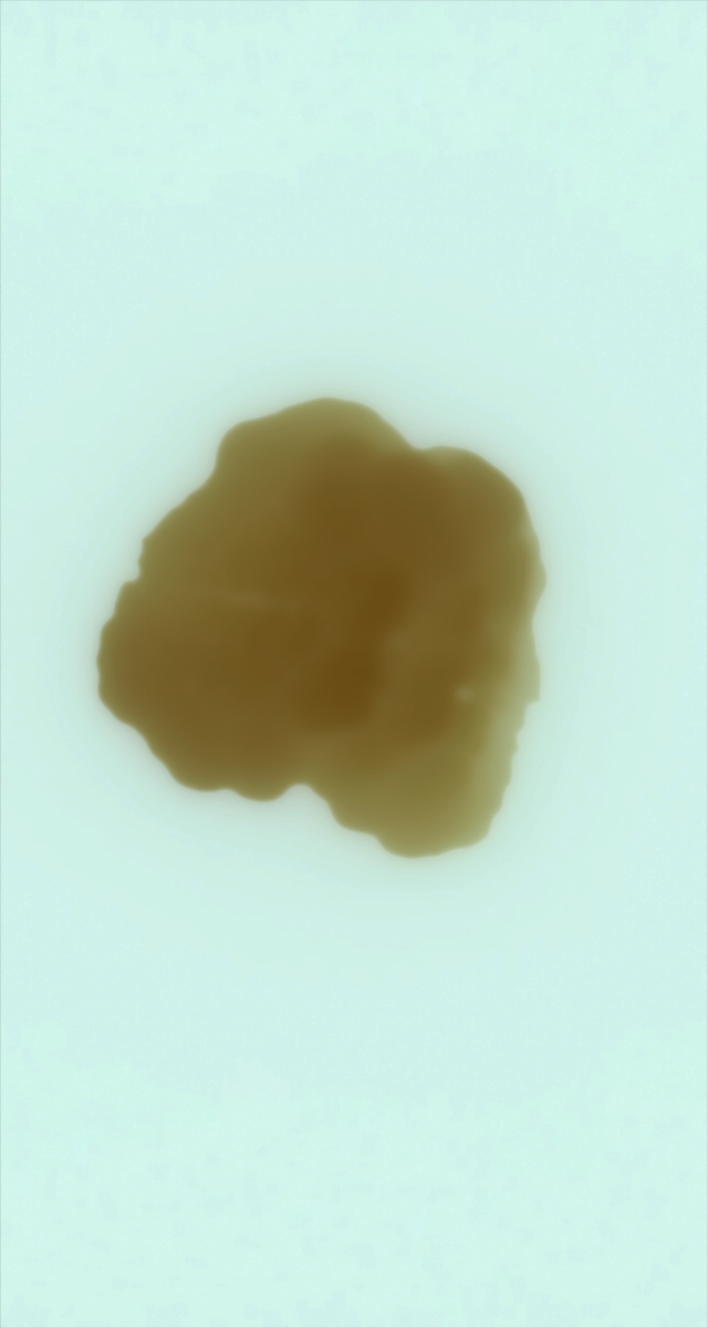 ultrasound_20260226_225026.jpg