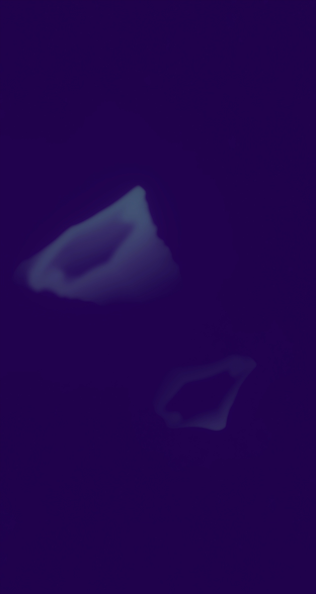 ultrasound_20260227_171832.jpg