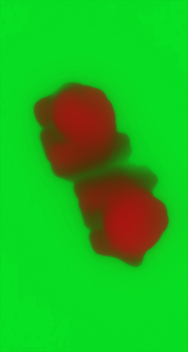 ultrasound_20260227_194844.jpg