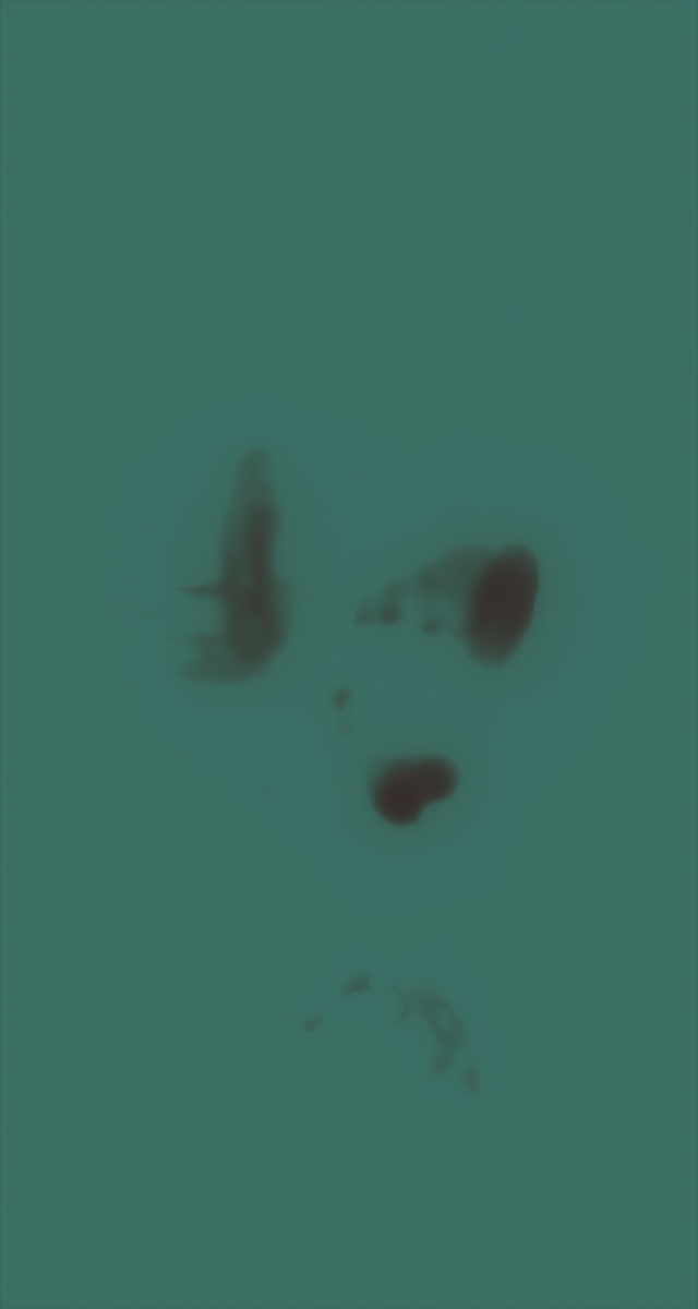 ultrasound_20260227_203436.jpg