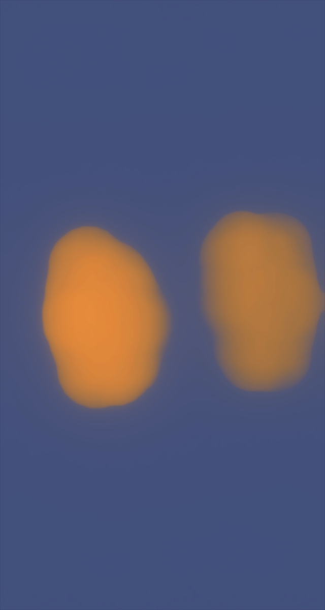 ultrasound_20260227_223621.jpg
