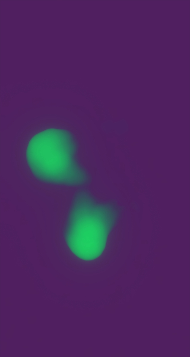 ultrasound_20260227_230345.jpg