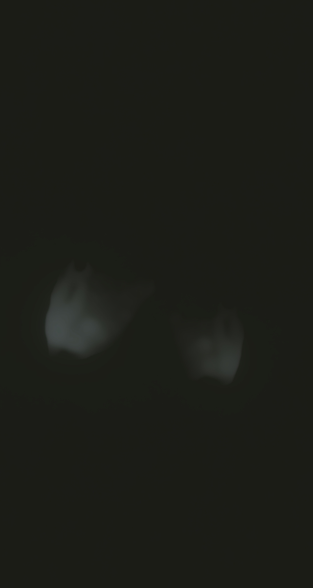 ultrasound_20260227_232637.jpg